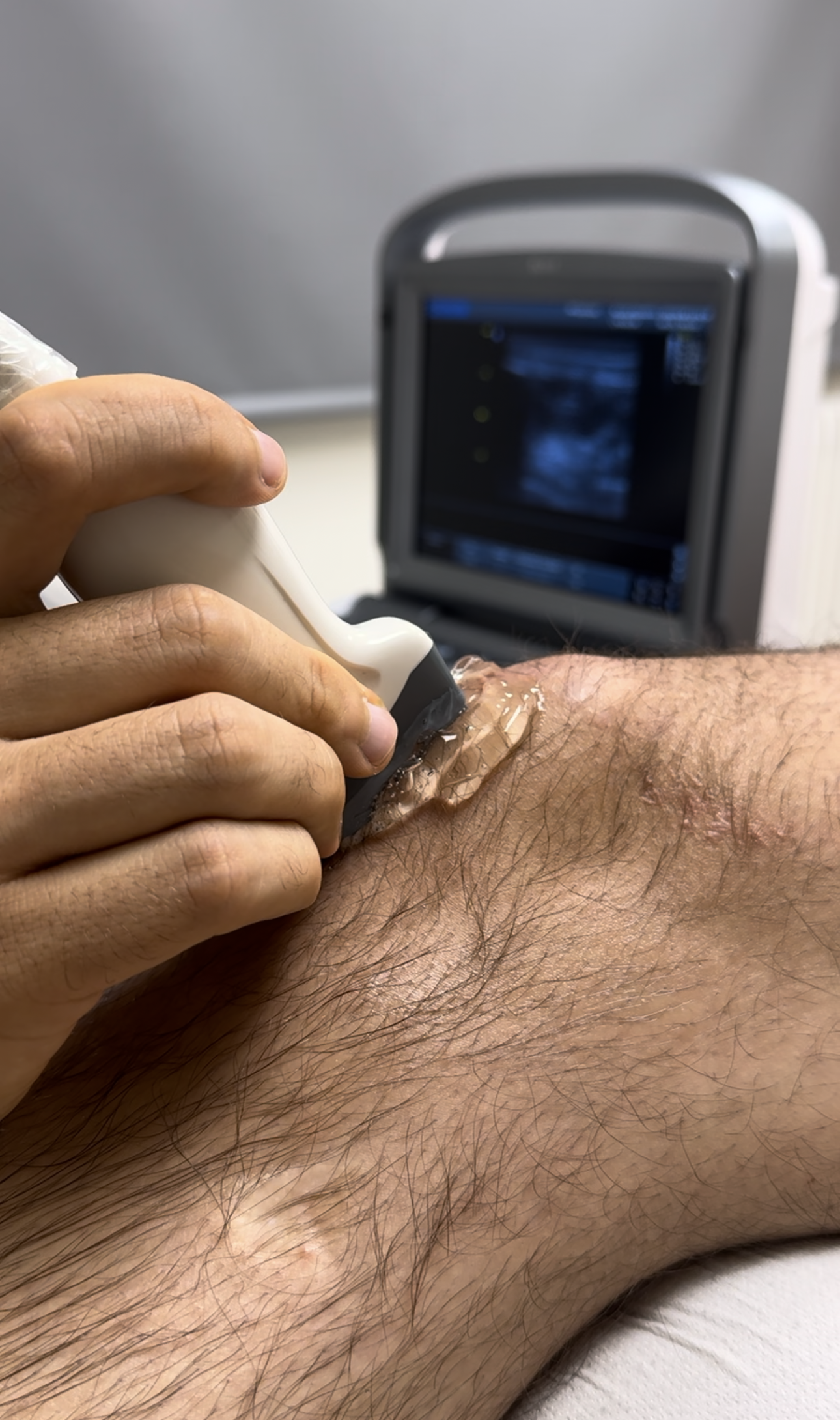 Ecografia múscul-esquelètica a PM Fisioteràpia per a un diagnòstic precís i tractaments ecoguiats a Sant Miquel de Balenyà